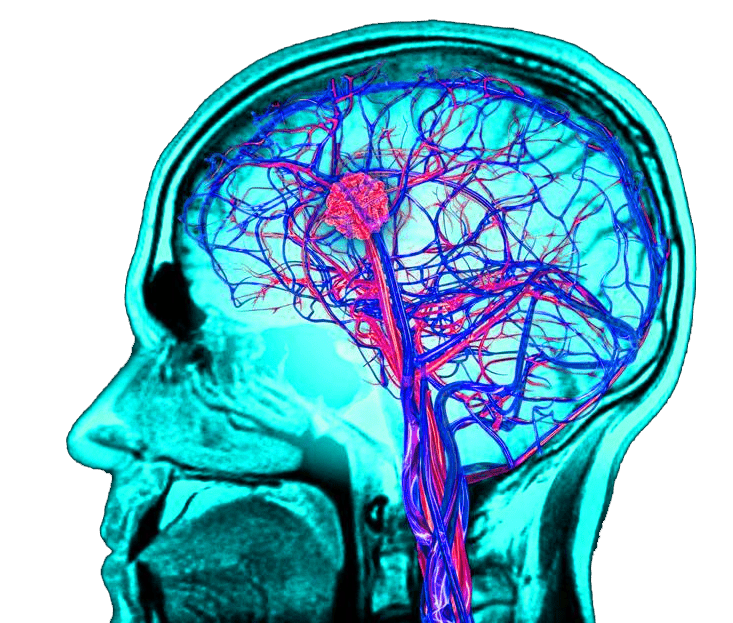 Причины гипоксии мозга